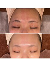 トータルエステティック ジョワイユ(JOYEUX)/☆プラズマシャワー×ジェット☆