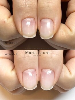 マリーロール 梅田店(Marie Laure)/自爪育成/深爪矯正/ネイルケア