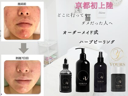ユアーズ ビューティー(YOURS beauty)の写真