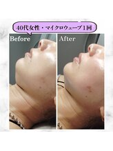 グランディールアン(GRANDIR UN)/フェイスラインスッキリ