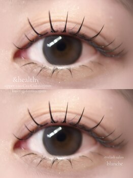 ブランシュ(blanche)/【upper-アンドヘルシー】