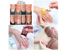 シッカネイル(sicca nail)