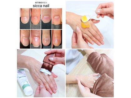 シッカネイル(sicca nail)の写真