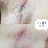 RiとBiのたまご