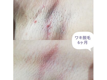 RiとBiのたまごの写真