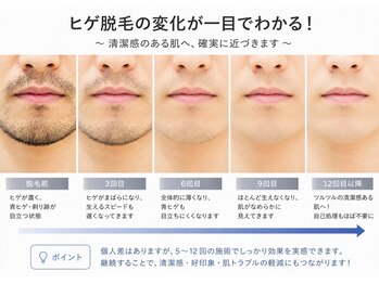 エイチビー(HB)/丁寧なカウンセリングで安心☆