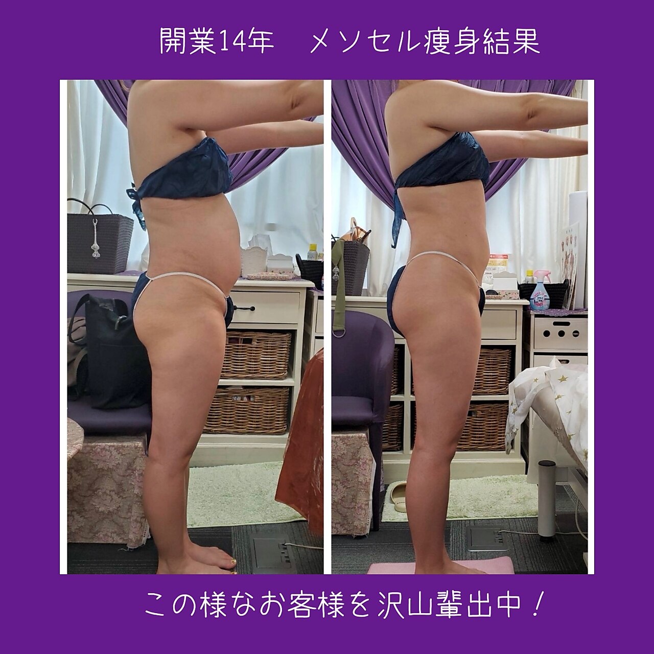 痩身専門サロン ラシュエット(La Chouette)｜ホットペッパービューティー