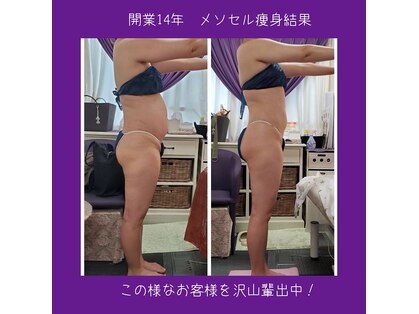 痩身専門サロン ラシュエット(La Chouette)の写真