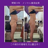 痩身専門サロン ラシュエット(La Chouette)