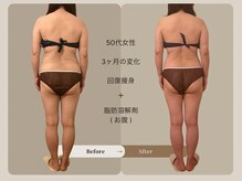 ソル 札幌平岸(Sol)の雰囲気（札幌/平岸/脂肪分解/回復エステ/代謝改善/肩こり/ダイエット）