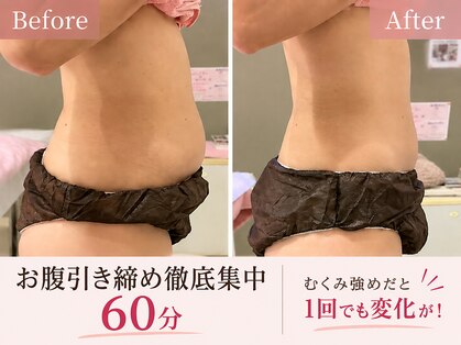 ビューティスト(Beautist)の写真
