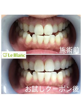 ルブラン 奈良店(Le Blanc)/大事な3SET!1