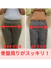 バンビ ビューティーラボ/産後で歪んでいました