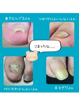 ユキネイル(YUKINAIL)/足の困った、おいで下さい