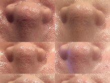 トータルビューティ リライフ(Total beauty Relife)/ハーブ光フェイシャル