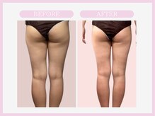 スリムライン 山形店(The Slim Line)/before→after