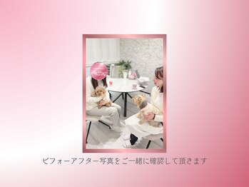 リス ブラン ビューティー(Lys blanc beauty)/アフタードリンク