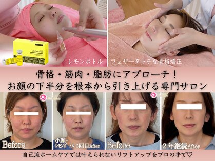 アンリエッタ(Unlieta)の写真