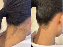 レネットサロン(Reinette Salon)の雰囲気（うなじワックス×光ダブル脱毛 ¥5,500）