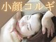 ロージースマイル(Rosy smile)の写真