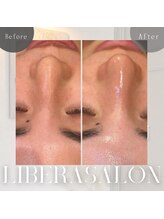 リベラサロン(LIBERA SALON)/ちゅるん♪ノーファンデ肌へ