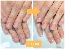 インブロッサム(imblossom)/深爪矯正/ナチュラルカラー