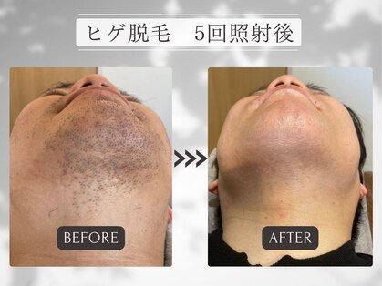 ル リエン(Le lien)の写真