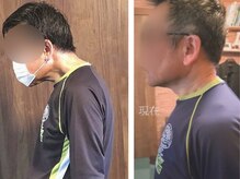 あん楽の雰囲気（首の歪みのお客様の姿勢矯正の例）