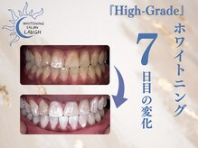 ラフ(LAUGH)/【審・美・白】 ホワイトニング