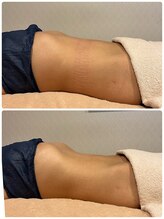 ビューティーサロン ラグジューム(Beauty salon Laxum)/赤岩式腸けずり