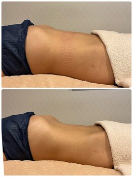 ビューティーサロン ラグジューム(Beauty salon Laxum)/赤岩式腸けずり