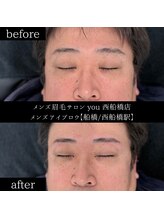 ユー 西船橋店(you)/ビフォーアフターお写真