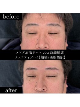 ユー 西船橋店(you)/ビフォーアフターお写真