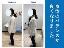 琴似じんぼ整体院/姿勢のお悩み、整体後の変化