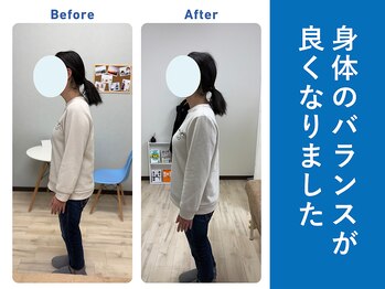 琴似じんぼ整体院/姿勢のお悩み、整体後の変化