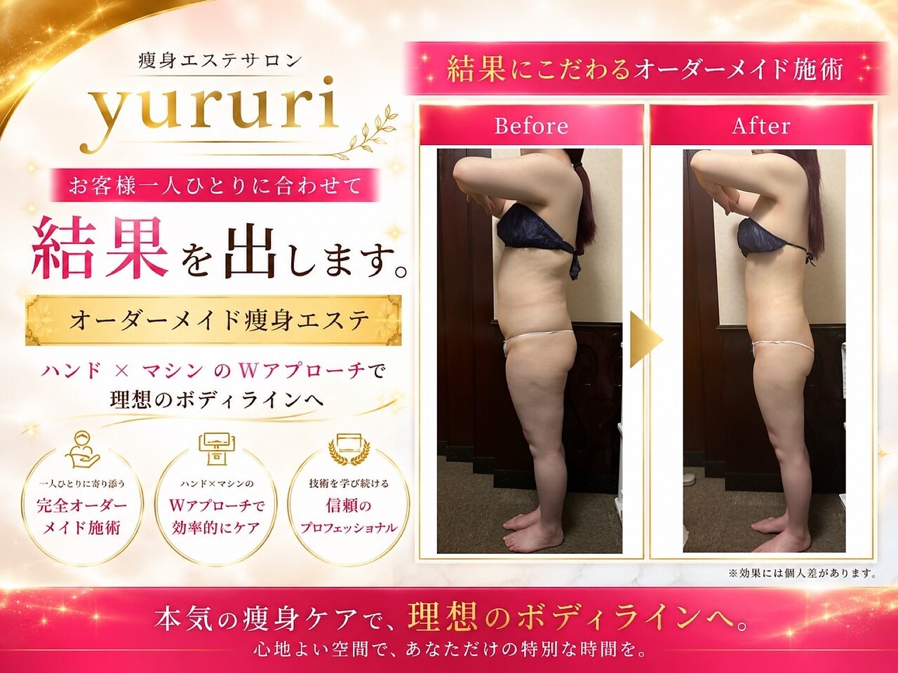 Puretrode REALIZE Beauty 痩身エステ器 ユルリ 水戸本店(yururi)｜ホットペッパービューティー
