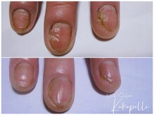 ココペリ(Nail Salon＆School kokopelli)の雰囲気（スタッフ1名、お客様1名のゆったり空間でトラブル爪も改善♪）
