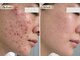 ハクビューティー(HAKU BEAUTY)の写真
