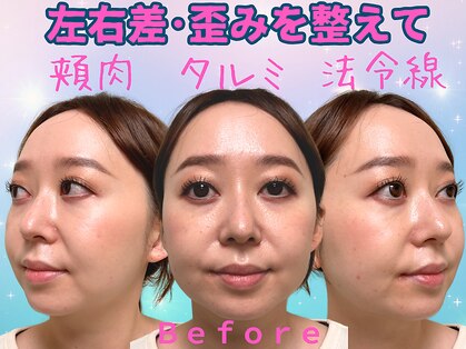 ナチュラルパーフェクトフェイス 新宿の写真