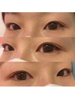 ラス 方南町駅前店(LATH)/3月○まつげ