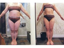 クイーン 札幌駅前店(Queen)/お客様　ビフォーアフター（9）