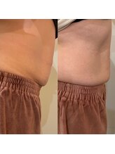 オリエンス(oriens)/ボディスカルプト