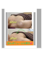 サロン ド マナ(Salon de Mana)/美乳メゾット