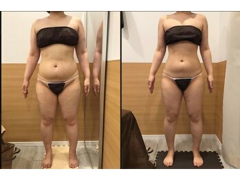 リッツ 大宮店/【Before/After】痩身