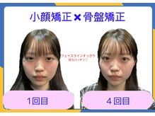 ビオラス 高崎店/目元ぱっちり小顔効果抜群！