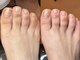ドクターネイル爪革命 札幌本店の写真/【夏に向けて足裏のがさがさ卒業◎自爪もピカピカに！美容メニューもお任せ！】ひび割れ/匂いの予防も◎
