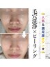 ＜リピーター様★＞毛穴洗浄＋お好きなピーリング+ヘッド5分 80分12,000円