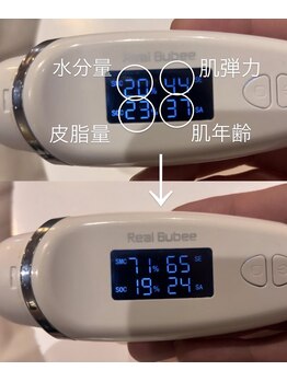 ビーブルーム(B BLOOM)/シミ、しわ、たるみ、ニキビケア