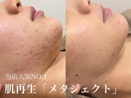 ビューティーサロン イル(BEAUTY SALON 16)の写真