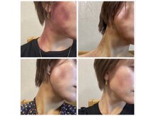 スピード美人 横浜店/BeforeAfter５